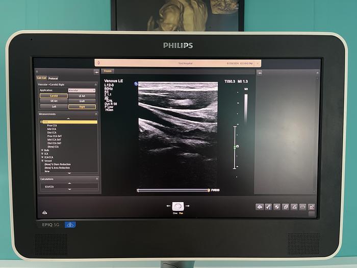 Used Philips EPIQ 5G Ultraschallgerät mit zwei Sonden