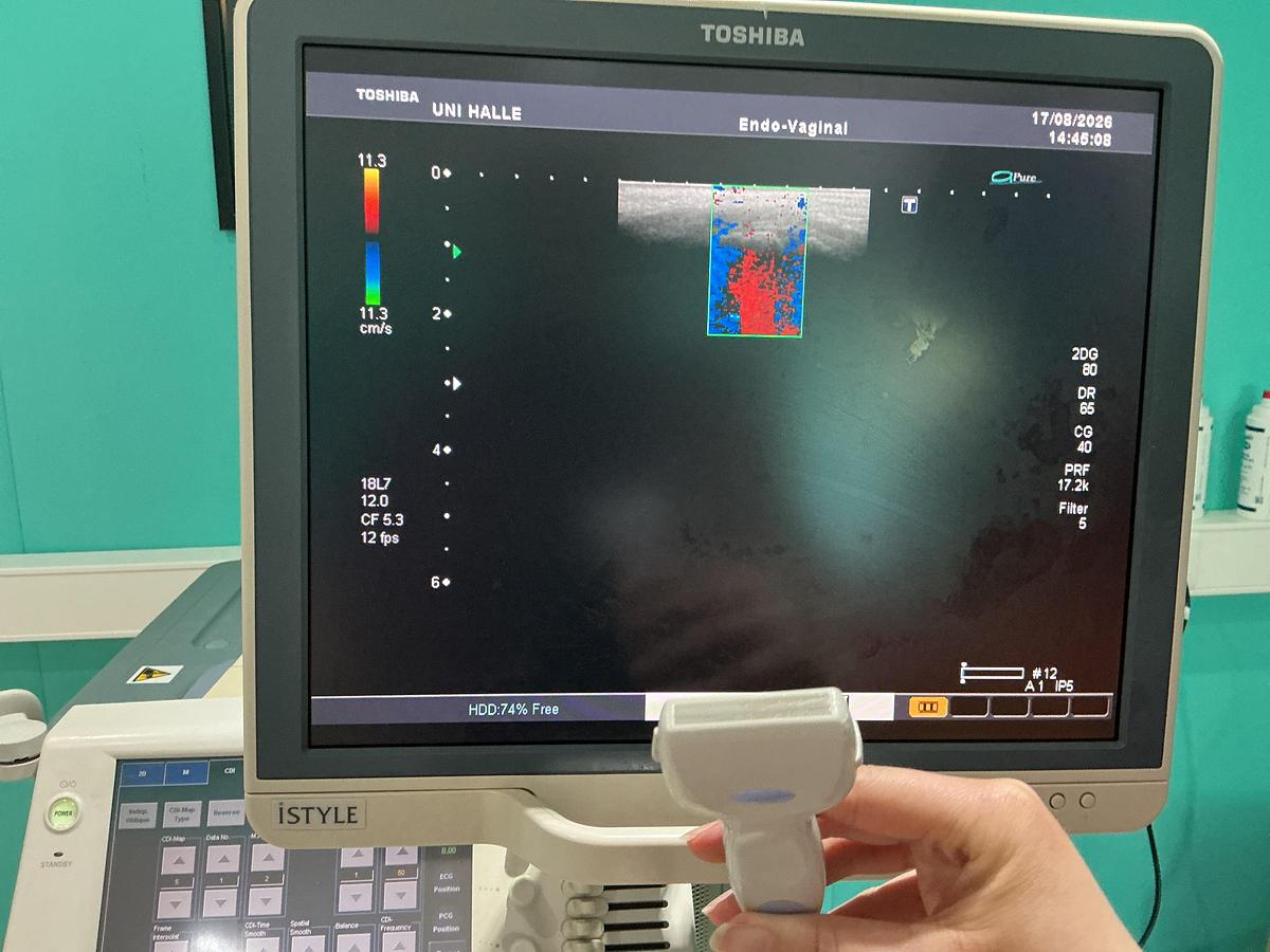 Gebraucht Toshiba PLT-1204BT Linear Ultraschallsonde