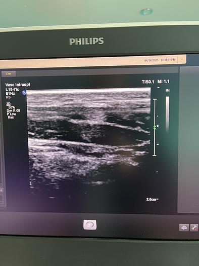 Gebraucht Philips L15-7io Linear Ultraschallsonde