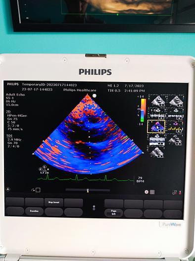 Gebraucht Philips CX50 Ultrasound with S5-1 and Trolly