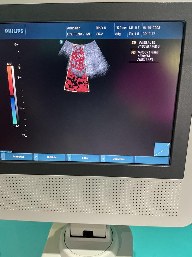 Gebraucht Philips HD3 Ultraschallgerät mit zwei Sonden