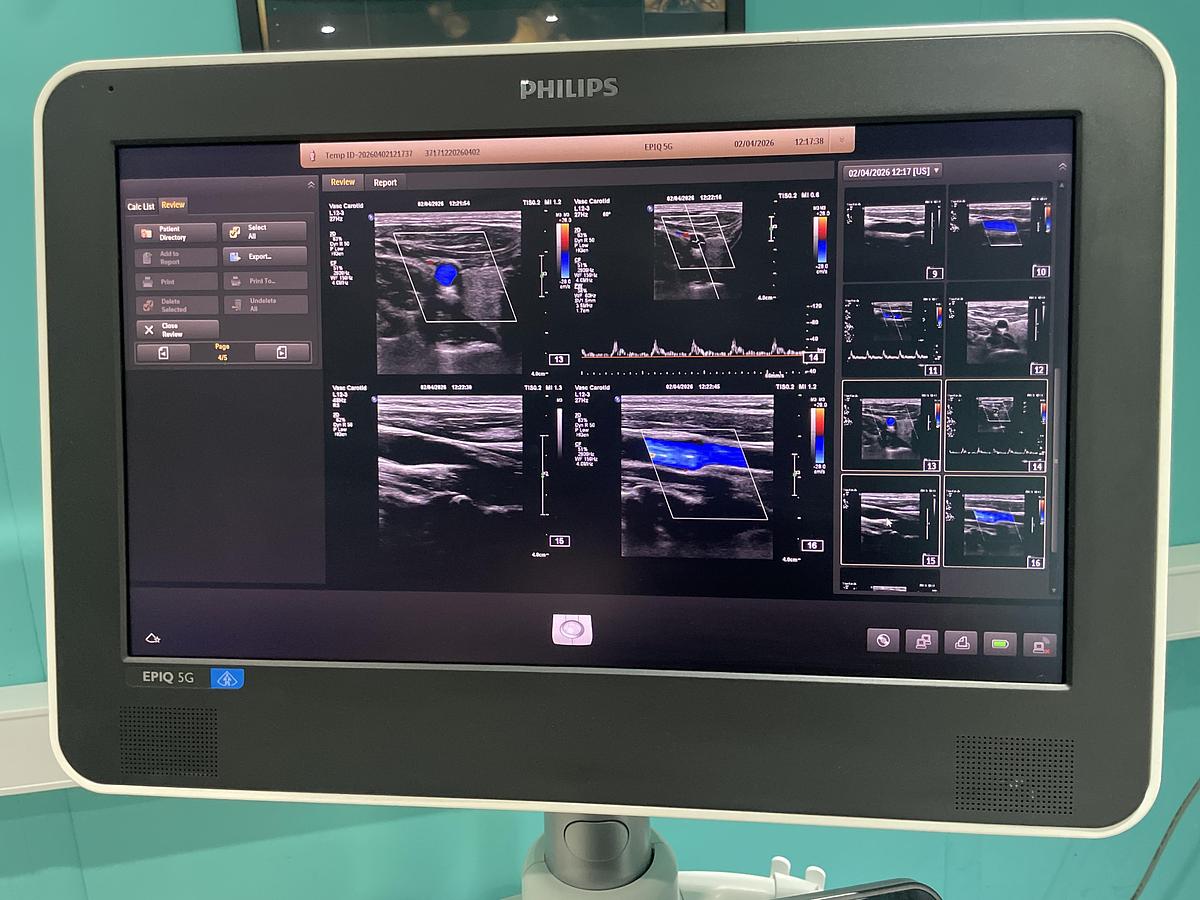 Gebraucht Philips Epiq 5G Ultraschallgerät mit drei Sonden