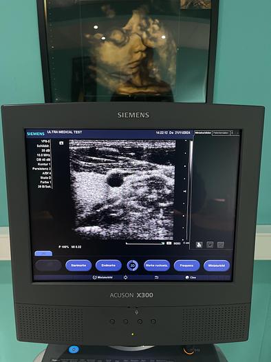 Used Siemens ACUSON X300 Ultraschallgerät mit drei Sonden 