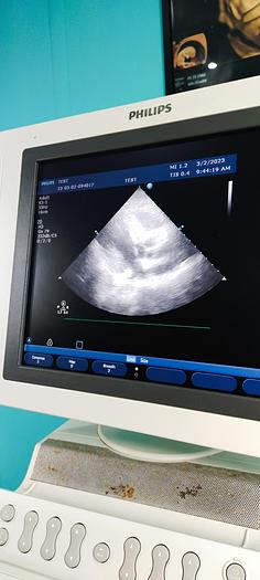 Gebraucht Philips HD11XE Ultraschallgerät mit 3 Sonde