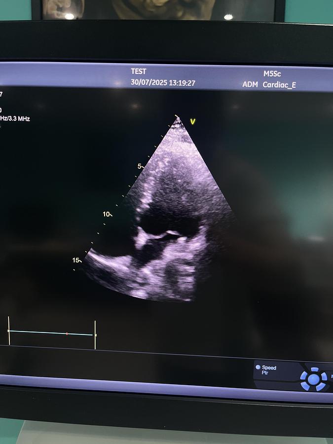 Gebraucht GE Vivid E95 V202 Ultraschallgerät mit M5Sc-D Kardiosonde