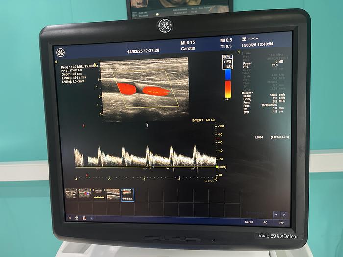 Gebraucht  GE ML6-15-D Ultraschallsonde