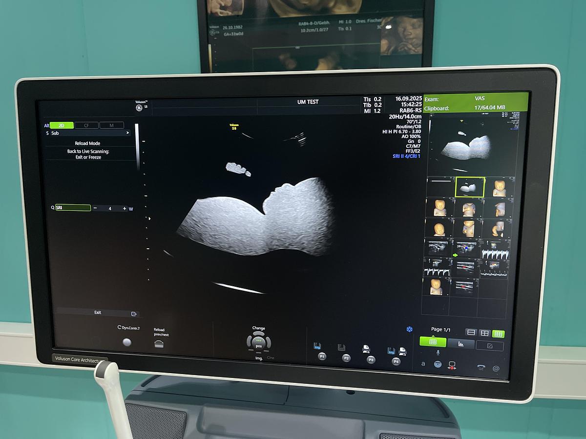 Gebraucht GE Voluson S8 Ultraschallgerät mit drei Sonden und Drucker