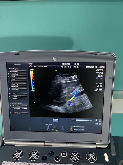 Gebraucht GE Voluson i Ultraschallgerät mit zwei Sonden 
