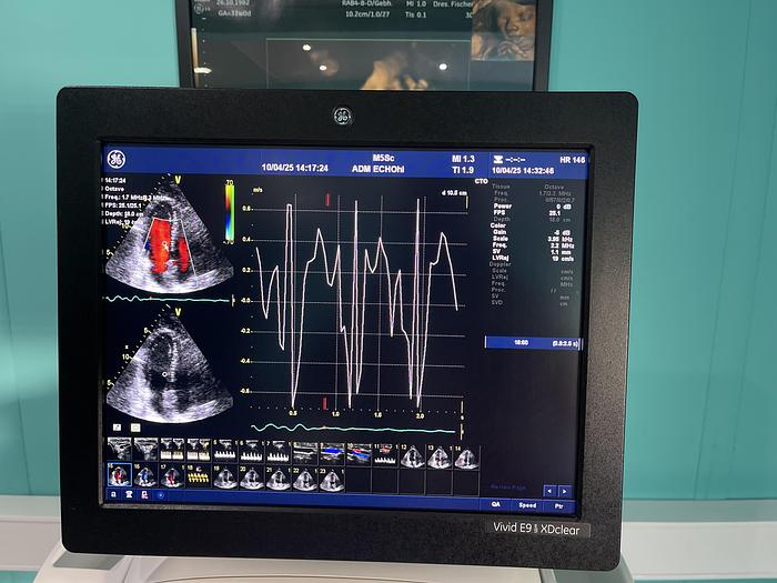 Gebraucht GE Vivid E9 XDclear Ultraschallgerät mit zwei Sonden und Drucker