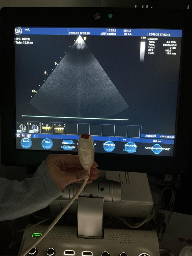 Gebraucht GE 10S-RS Kardio Ultraschallsonde