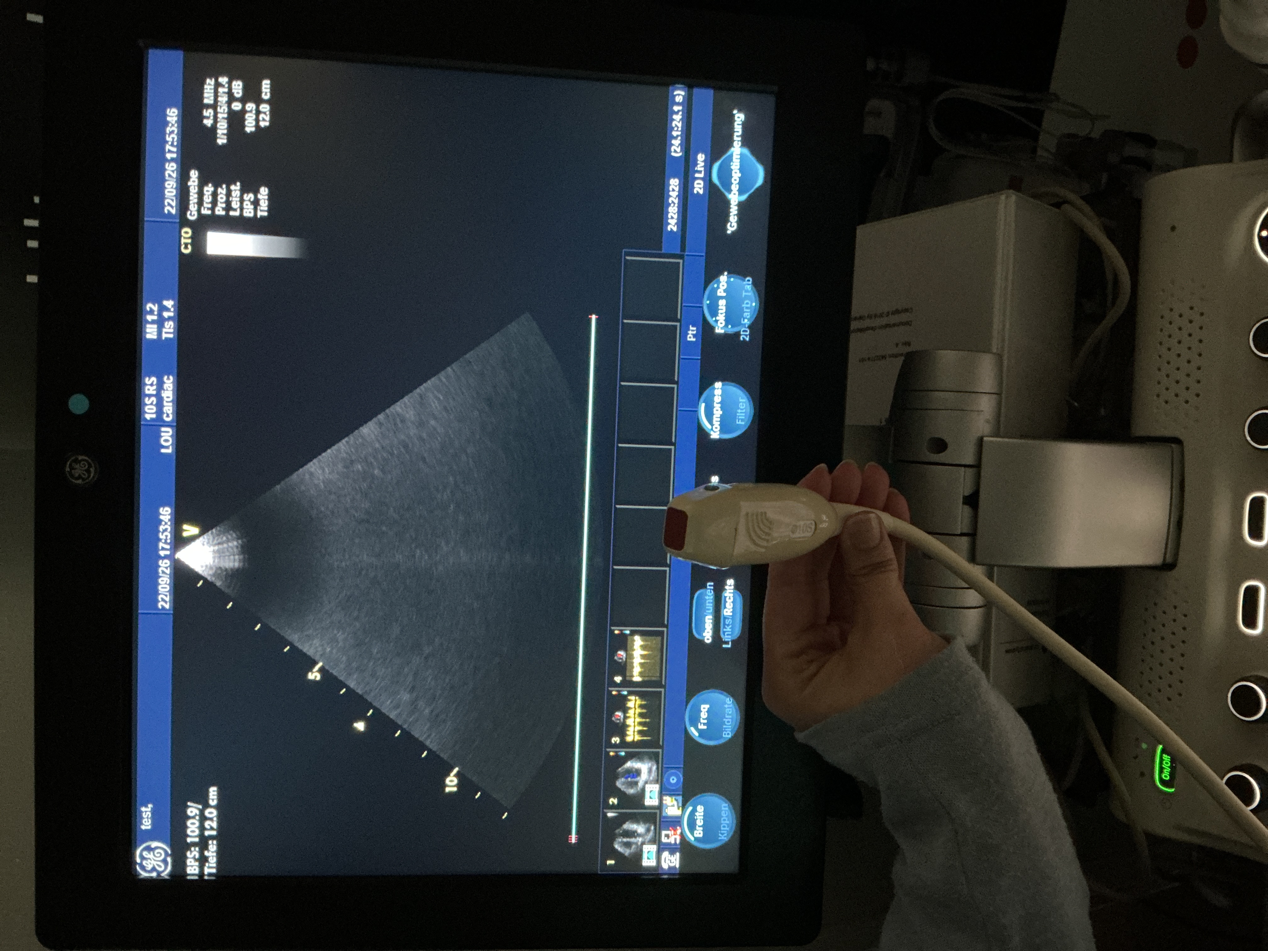 Gebraucht GE 10S-RS Kardio Ultraschallsonde