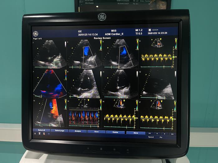 Gebraucht GE Vivid E9 Ultraschallgerät mit Kardiosonde und Drucker