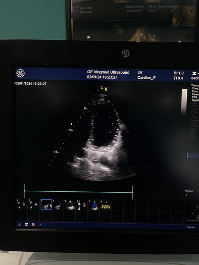 Gebraucht GE Healthcare Vivid E9 Ultraschall Gerät mit zwei Sonden