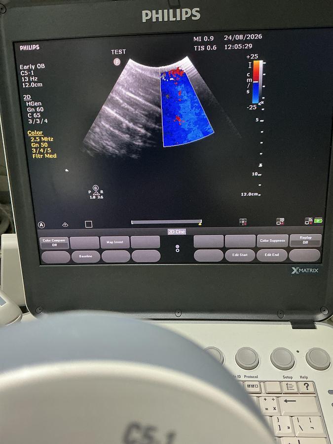 Gebraucht Philips C5-1 compact konvex Ultraschallsonde 