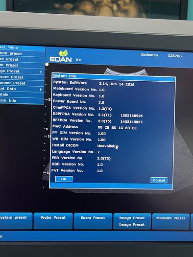 Used EDAN U2 Ultraschallgerät mit drei Sonden und Drucker