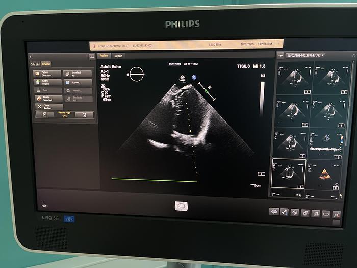 Used Philips X5-1 Sektor Ultraschallsonde
