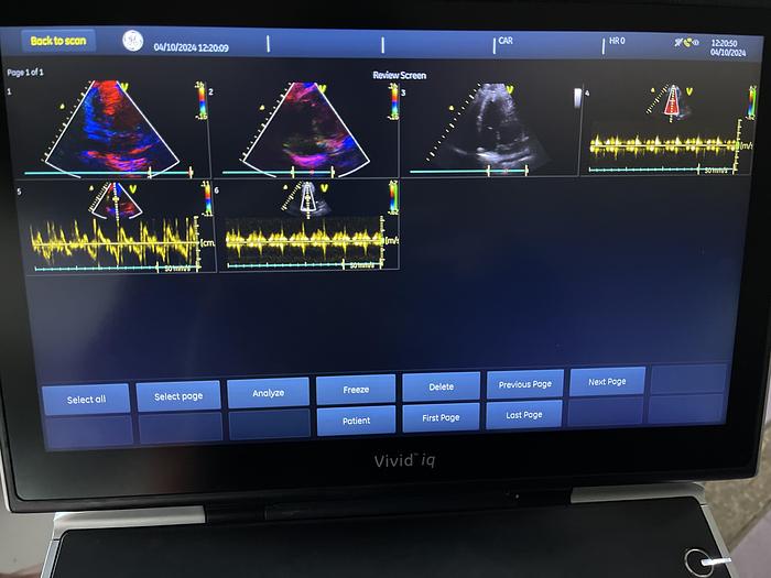Used GE 3SC-RS Sektor Ultraschallsonde 