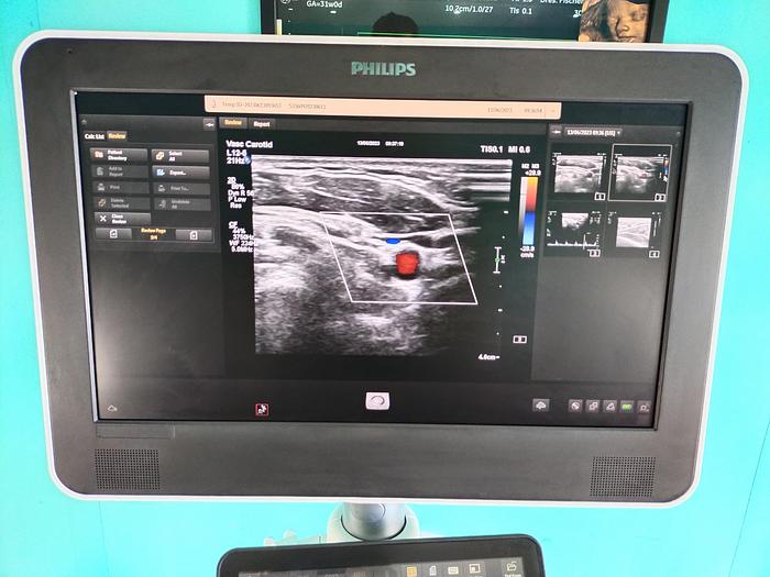 Gebraucht Philips  Affiniti 70G Screen Ultrasound Scanner 