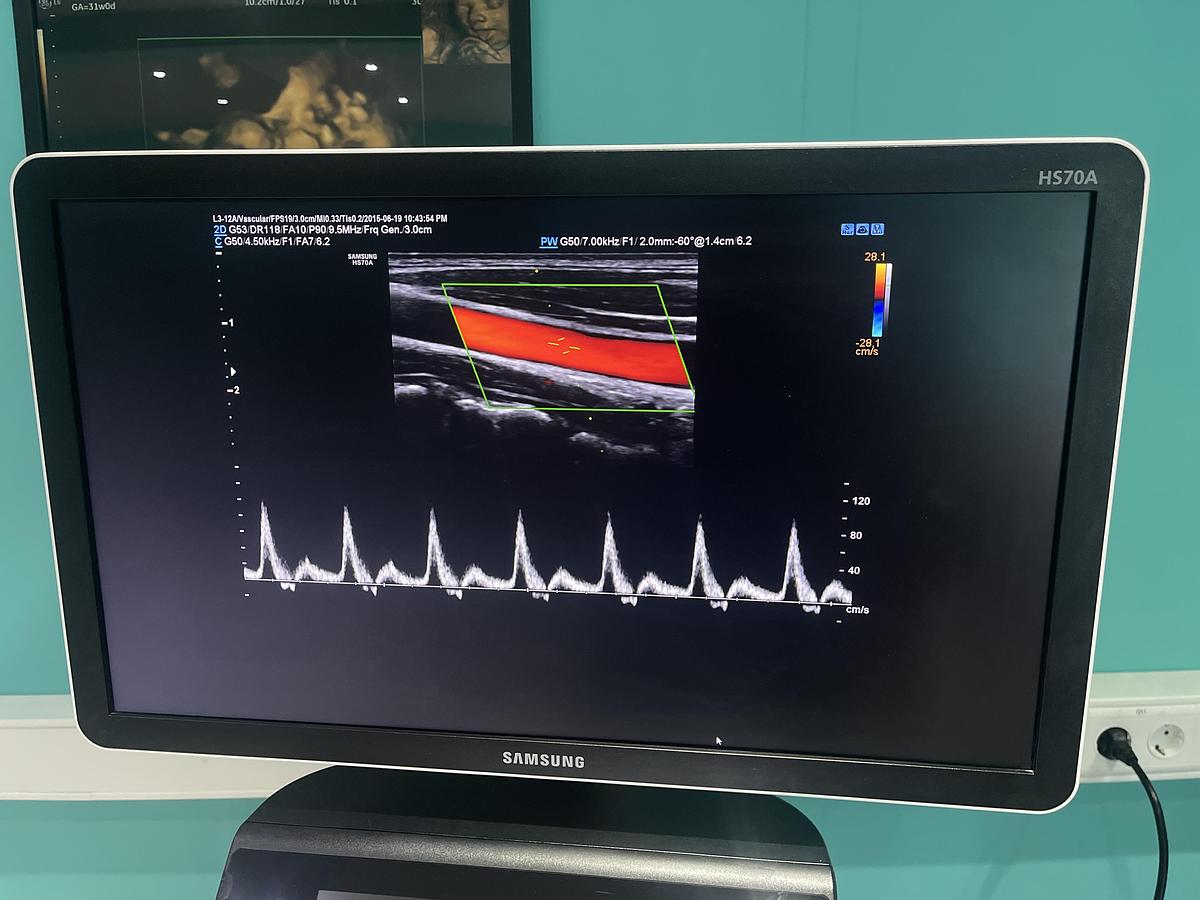 Gebraucht Samsung HS70A Ultraschallgerät mit drei Sonden