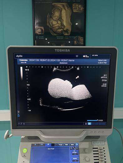 Used Toshiba Aplio 400 Ultraschallgerät mit 2 Sonden