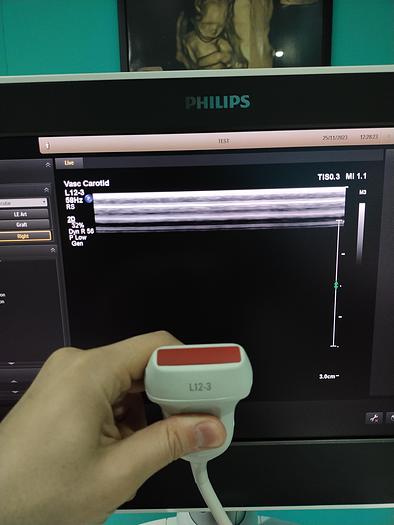 Gebraucht Ultraschallgerät Philips EPIQ 5