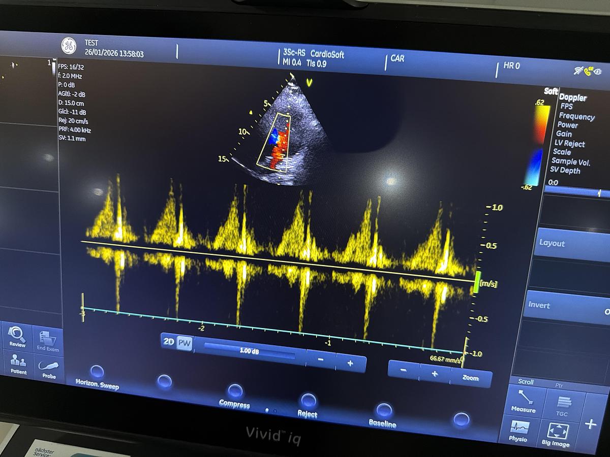 Gebraucht GE 3SC-RS Kardio Ultraschallsonde