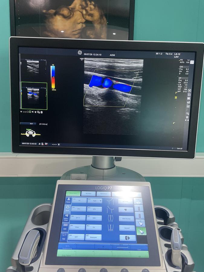 Gebraucht GE LOGIQ P7 Ultraschallgerät mit zwei Sonden
