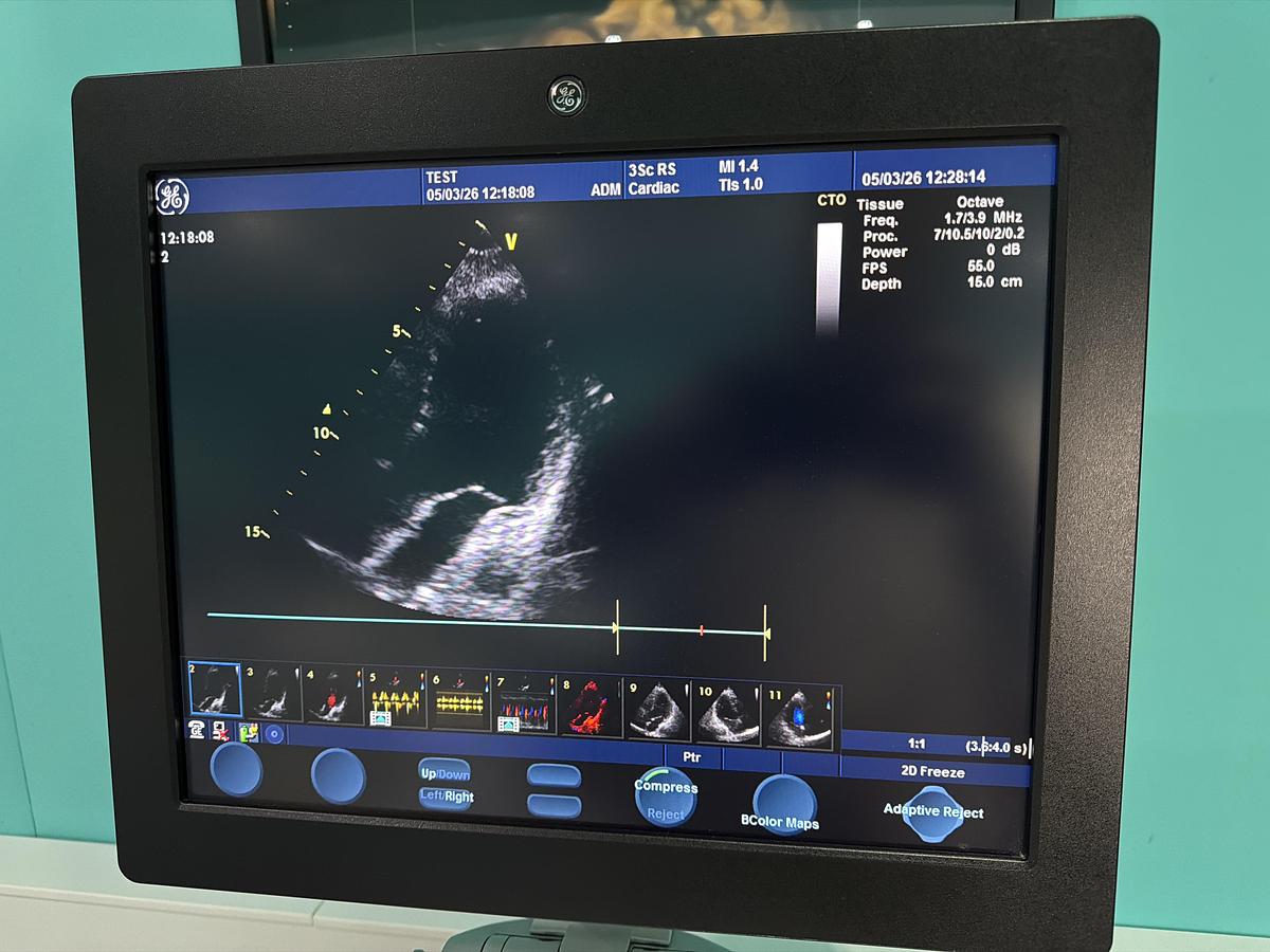 Gebraucht GE Vivid S6 Ultraschallgerät mit 3Sc-RS kardio Sonde