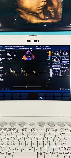 Gebraucht Philips CX50 Ultraschallgerät mit Sektor Sonde SW 2.5.1