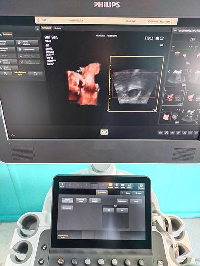 Gebraucht Philips V6-2  3D/4D  Volumen Ultraschallsonde
