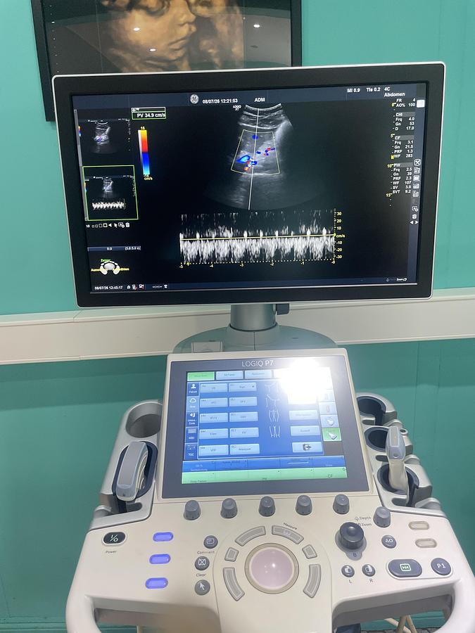 Gebraucht GE LOGIQ P7 Ultraschallgerät mit zwei Sonden