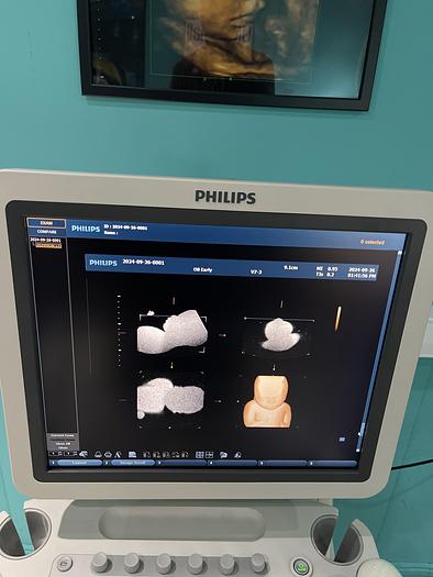 Used Philips HD9 Ultraschallgerät mit drei Sonden