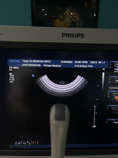 Gebraucht Philips iU22 Ultraschallgerät mit drei Ultraschallsonden