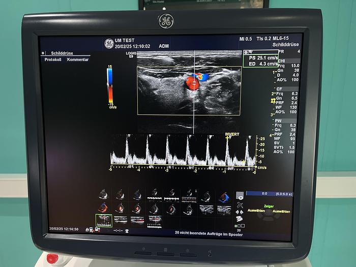 Gebraucht GE LOGIQ E9 Ultraschallgerät mit 2 Sonden und Drucker 