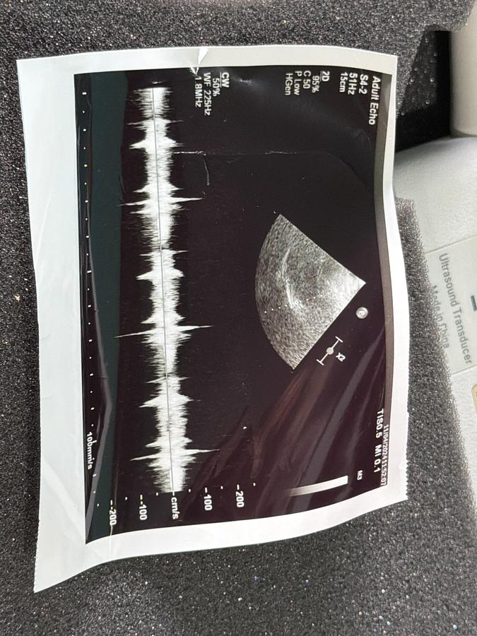 Gebraucht Philips S4-2 Kardio Ultraschallsonde 