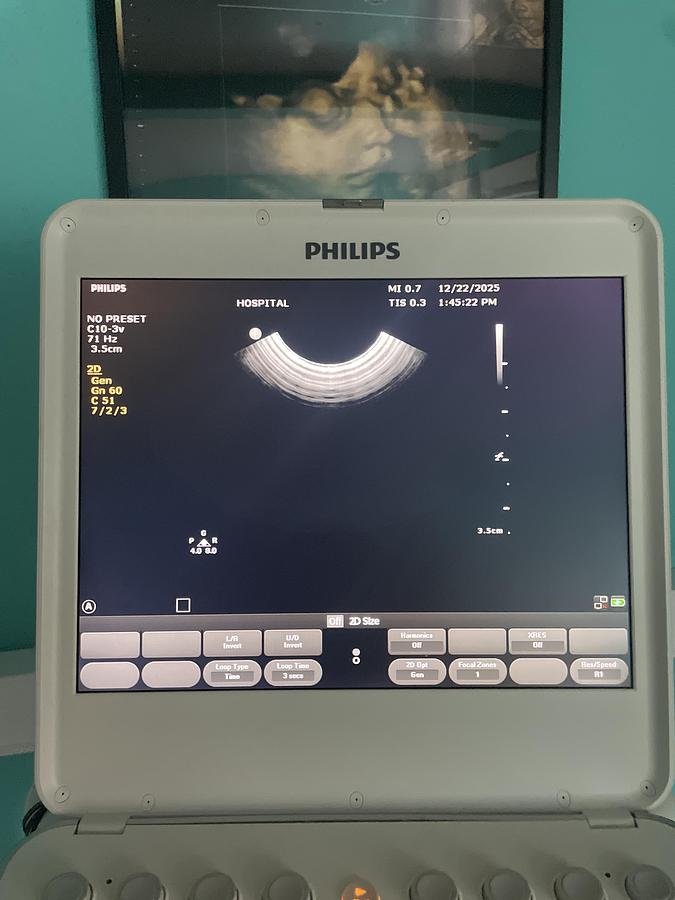 Gebraucht Philips C10-3V Endovaginal Ultraschallsonde 