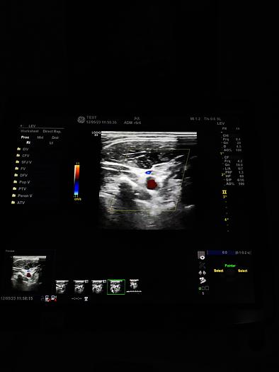Gebraucht GE LOGIQ E9 Flachbildschirm-Ultraschallgerät inkl. 1 Sonde, Drucker und DVD-Brenner