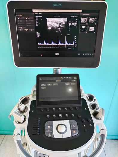 Gebraucht Philips  Affiniti 70G Screen Ultrasound Scanner 