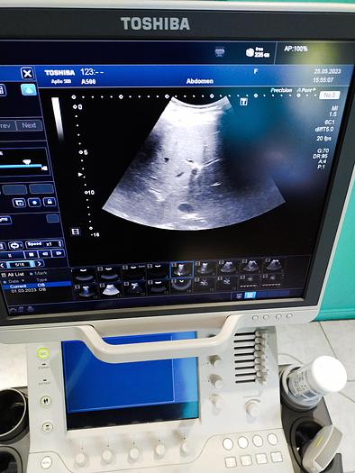 Gebraucht Toshiba Aplio 500 Ultraschallgerät mit 3 Sonden