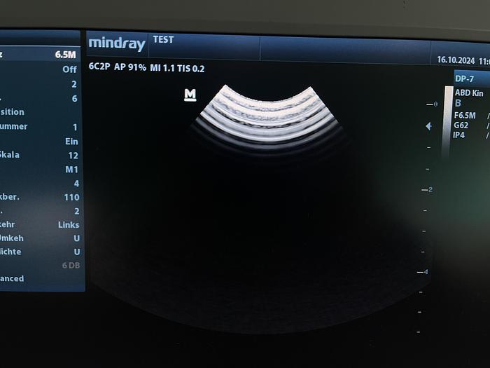 Mindray 6C2P Konvex Ultraschallsonde