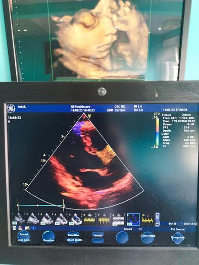 Gebraucht GE  Vivid S5  Ultraschallgerät auf Trolley mit 2 Sonden und EKG Kabel