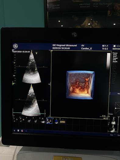 Gebraucht GE Healthcare Vivid E9 Ultraschall Gerät mit zwei Sonden