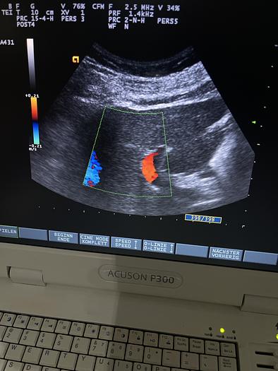 Used Esaote CA431 Konvex Ultraschallsonde