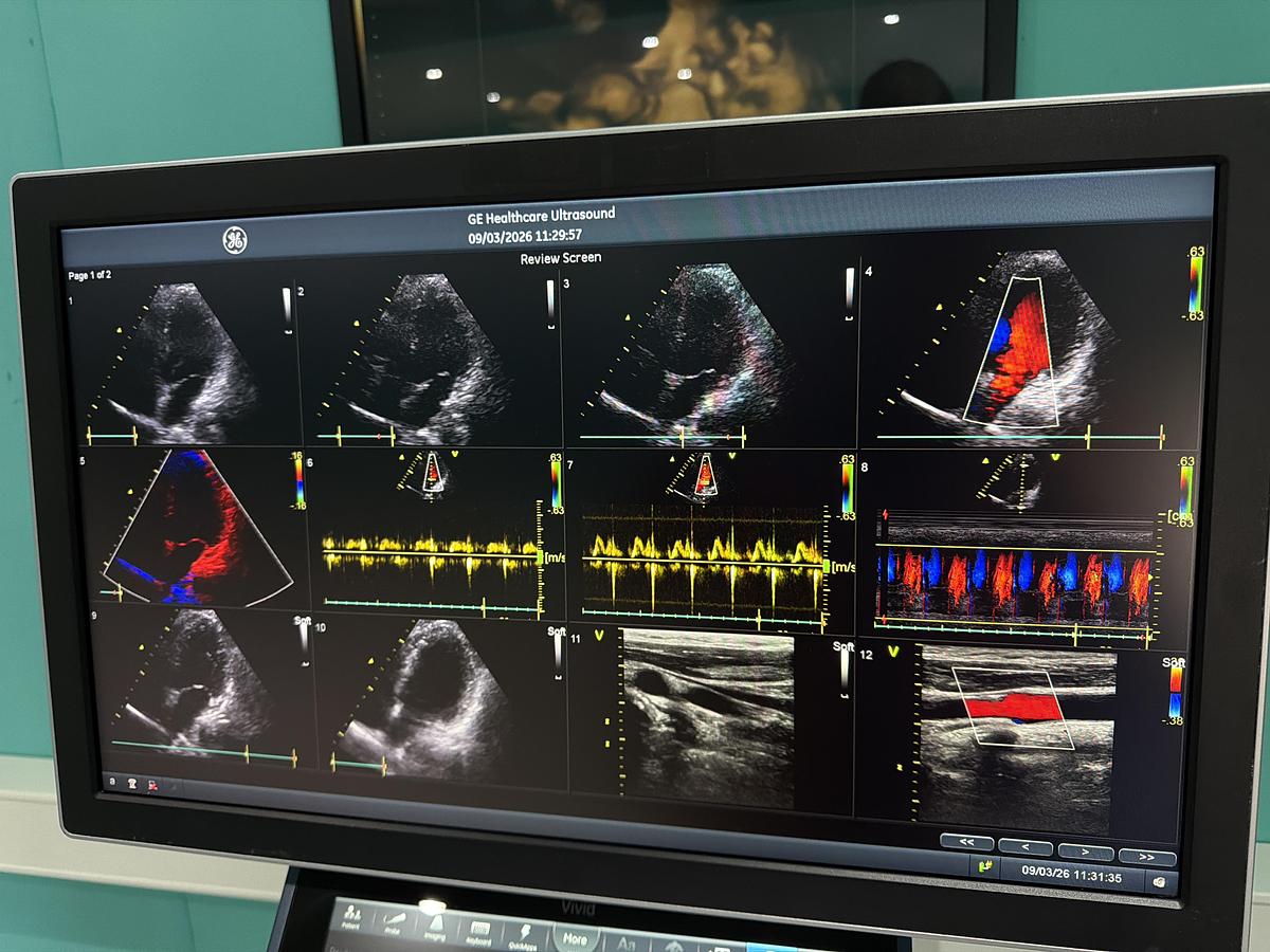 Gebraucht Vivid S70N Ultrasound 