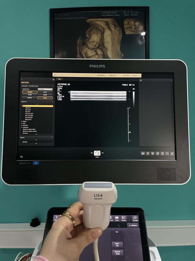 Gebraucht Philips L12-4 Linear Ultraschallsonde