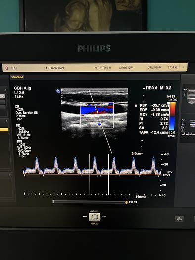 Gebraucht Philips Affiniti 50W Ultraschallgerät mit 3 Sonden und Drucker SV 9.0.5