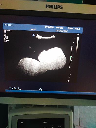 Gebraucht Philips Ultraschall-Sonde C9-4 Ultrasoundprobe