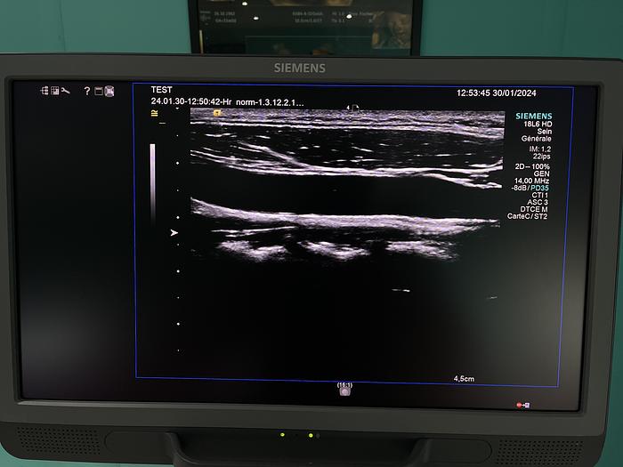 Gebraucht HELX Evoulution Acusion S2000 von Siemens Ultraschall Gerät mit drei Sonden