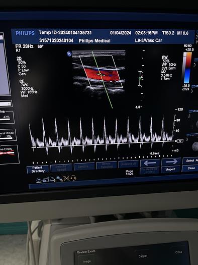 Gebraucht Philips iU22 Ultraschallgerät mit drei Ultraschallsonden