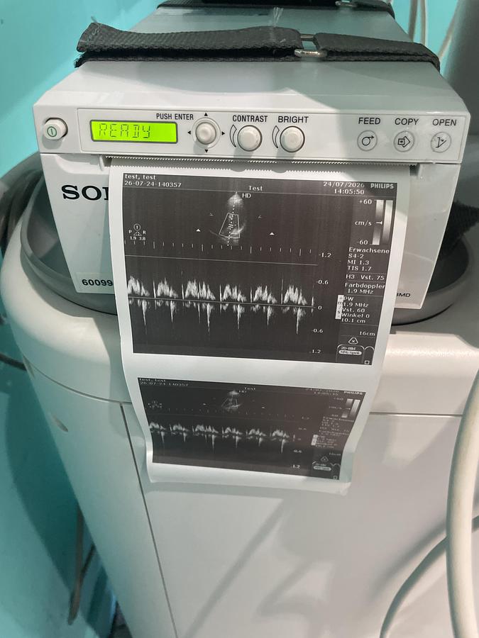 Gebraucht Philips HD5 Ultraschallgerät mit zwei Sonden und Drucker